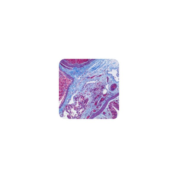 Trichrome Stain Kit
